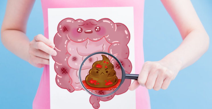 便秘不算“病”嗎？七種情況的便秘，可能是腫瘤先兆！